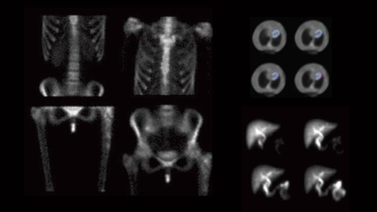 Photo of Digirad images